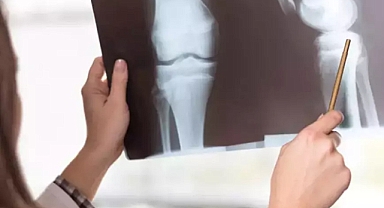 Kemik sağlığını korumak için basit adımlar