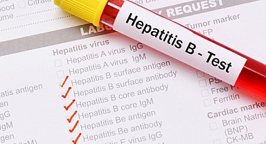 Türkiye nüfusunun yüzde 5 ila 7’si farkında olmaksızın Hepatit B virüsünü taşıyor!