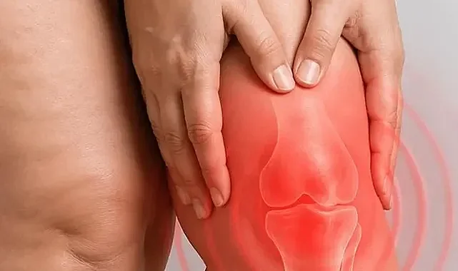 Diz biyomekaniğini bozan süreç: Lipödem