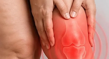 Diz biyomekaniğini bozan süreç: Lipödem